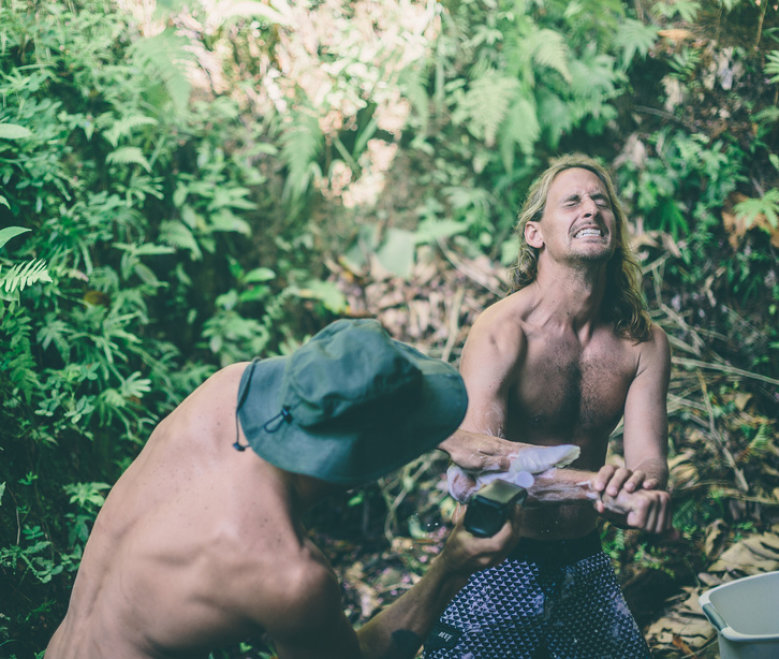 How to Treat Reef Rash, Coral Reef Cuts & Barnacle Cuts From Surfing