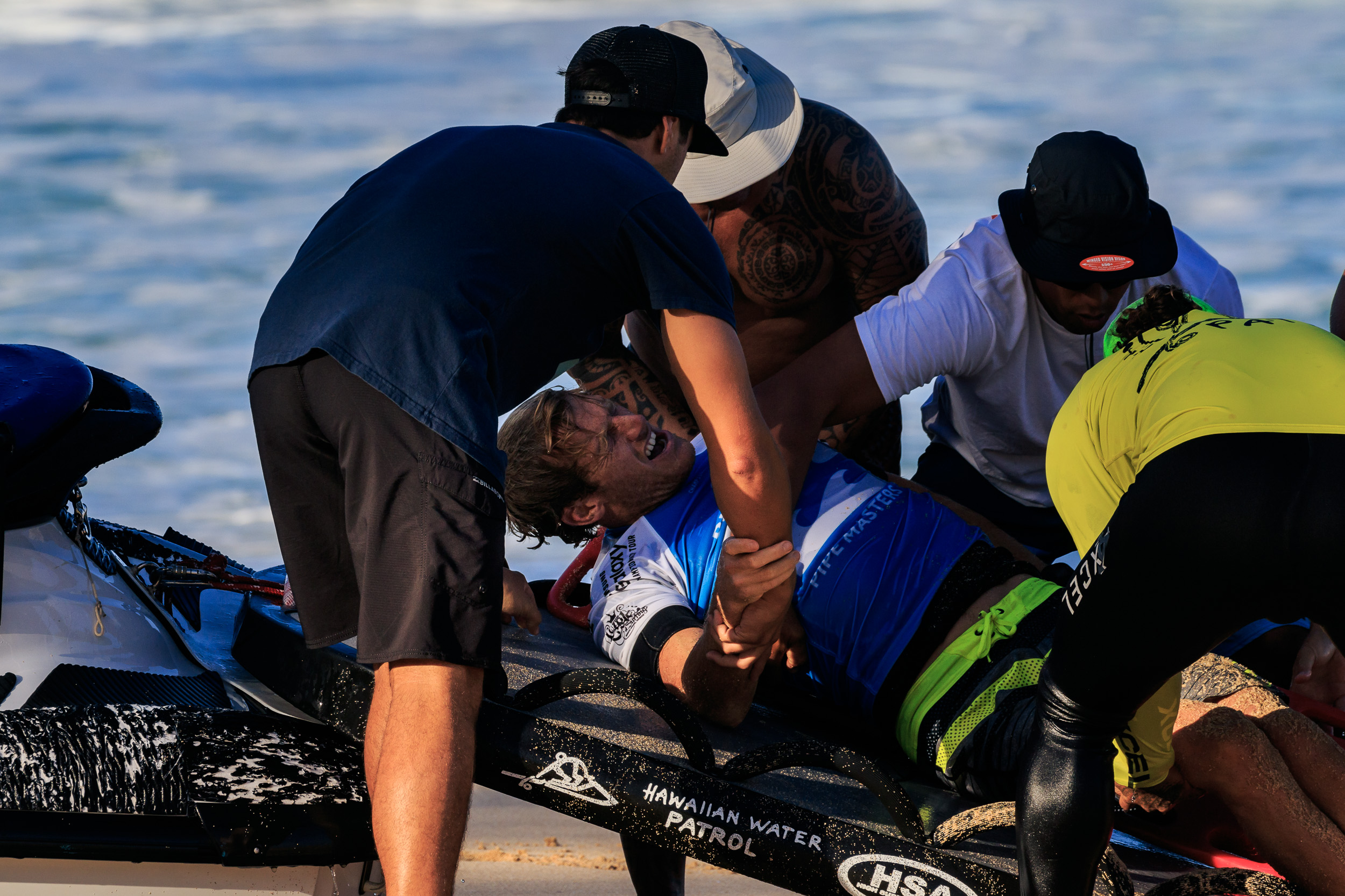 Pro Surfing Injuries And Reef Cuts, Explained
